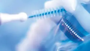 Cómo Cuidar Tus Implantes Dentales: Guía Completa